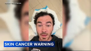 Kevin Jonas gets surgery to remove basal cell carcinoma skin cancer [upl. by Allisirp521]