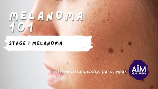 What is Stage I Melanoma [upl. by Dawkins]