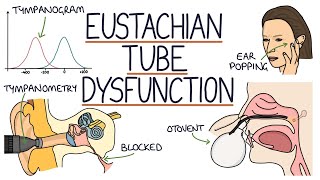 Understanding Eustachian Tube Dysfunction [upl. by Davena]