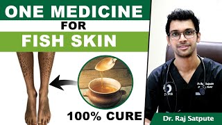 One Medicine To Cure Ichthyosis Vulgaris FISH SKIN  How to Cure FISH SKIN Naturally amp Permanently [upl. by Anoy]