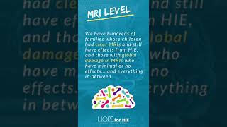 HIE Levels Explained  Hypoxic Ischemic Encephalopathy [upl. by Birmingham]