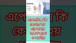 Appendix Symptoms  অ্যাপেন্ডিক্স এর লক্ষণ  অ্যাপেন্ডিক্স হলে কি করবেন  appendicitis trending [upl. by Weinstein]