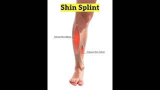 Shin Splints Explained [upl. by Naihtsirc]