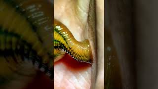 Leech bite under the microscope [upl. by Assehc]