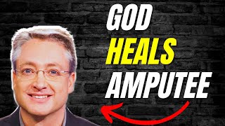 Is This Evidence That God DOES Heal Amputees [upl. by Nohsauq]