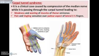 Overview of UL 14  Deep Fascia of Palm of the Hand  Dr Ahmed Farid [upl. by Sorcim696]