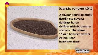 Tıbbi Bitkiler  Üzerklik Tohumu  DİYANET TV [upl. by Charlena]