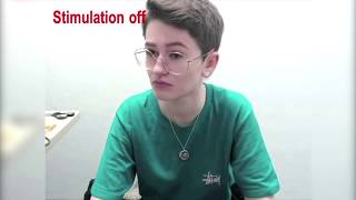 Watch as tiny shocks ‘turn off’ Tourette Syndrome tics [upl. by Casie252]