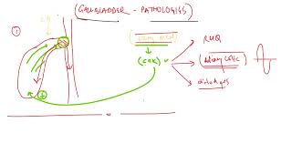 Acute Cholecystitis Made Easy  Usmle step 1 speedymedical [upl. by Einre]