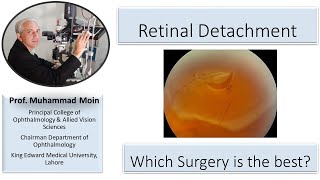 Retinal Detachment How to choose which surgery is the best [upl. by Longerich]