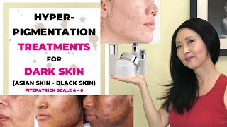 Hyperpigmentation Treatments for Dark Skin [upl. by Buck624]