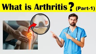 What is Arthritis  Anatomy of JointHealthyArthritis Different Types of Arthritis  Part1 [upl. by Wurtz94]