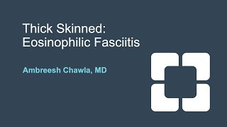 Diagnosis and Treatment of Eosinophilic Fasciitis [upl. by Nnauol]