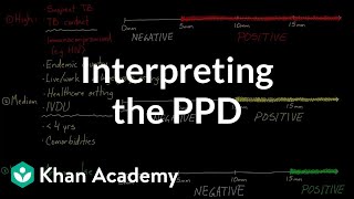 Interpreting the PPD  Infectious diseases  NCLEXRN  Khan Academy [upl. by Awra415]