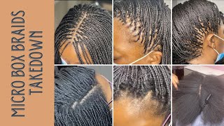 Micro Box Braids TAKEDOWN After 4 MONTHS [upl. by Niai]