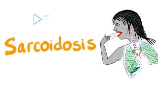 Sarcoidosis  Restrictive Lung Disease  Pulmonology [upl. by Nnyleahs]