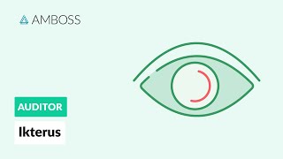 Differentialdiagnostik des Ikterus  AMBOSS Auditor [upl. by Nerhtak]