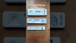 HIV HCV HbSag test  HIVHbSagHCV test kaise kare  pathology medical shorts [upl. by Hersch]