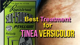 Effective Treatment for Tinea  Pityriasis Versicolor Skin Fungus  Psyllium Husk  Natural Remedy [upl. by Ahsekahs]