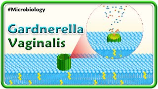 Gardnerella Vaginalis  Microbiology USMLE Step 1 [upl. by Anuahsal]