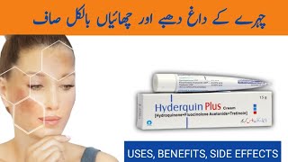 How To Treat Pigmentation  Chehre ki Chaiyon ka Ilaaj [upl. by Mclaurin]