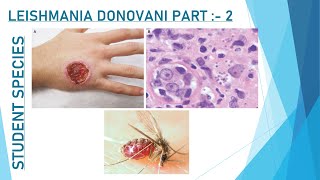 Leishmania Donovani BSc SEM 6 [upl. by Ybrik]