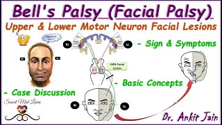 Bells palsy Upper and Lower motor neuron facial palsy Central facial palsyAnatomy Simplified [upl. by Sualkcin]