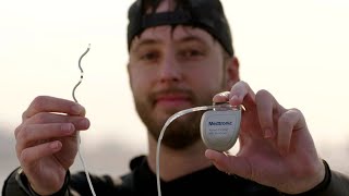 Harrisons story Living with the Medtronic EVICD™ system [upl. by Enirac]