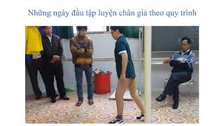 Hemipelvectomy Prosthesis  Chân Giả tháo hoàn toàn xương cánh chậu [upl. by Sila]