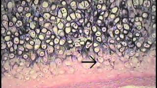 Cartilage and Bone Histology FreeMedEd [upl. by Farrington]