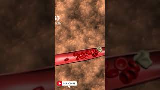 Visualizing Ischemic Stroke  Animation Guide to Brain Blockages 🧠 [upl. by Cordelia]