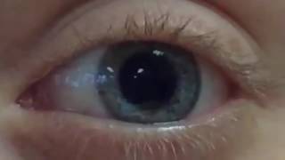 Pupil Dilation and Contraction [upl. by Ellen486]