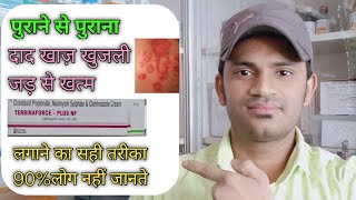 Terbinaforce plus nf cream use benefits and Side effects full review in hindi [upl. by Regdor]