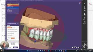 How to Basic Full Denture Design in Exocad [upl. by Sugna]