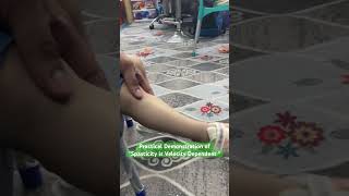 Spasticity is Velocity Dependent  Practical Demonstration [upl. by Mazman669]