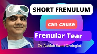 Short Frenulum leading to Frenular tear  All you need to know [upl. by Warner]