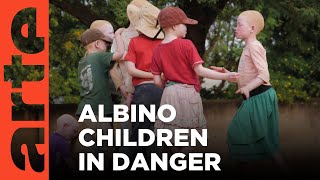 Tanzania Albinos Stolen Childhood  ARTEtv Documentary [upl. by Ardua]