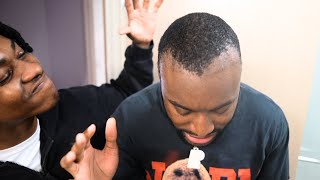 My Family DESTROYED My Hairline Surgery [upl. by Anaahs840]