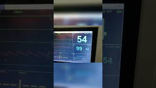 Power Supply Fix Patient Monitor is Working Perfectly [upl. by Stultz]