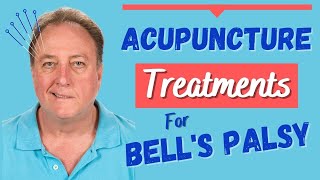 The Power of Acupuncture in Treating Bells Palsy acupuncture [upl. by Nayd]