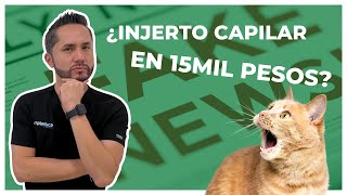 Precio Injerto Capilar MÉXICO 👈👀 [upl. by Oiramel]