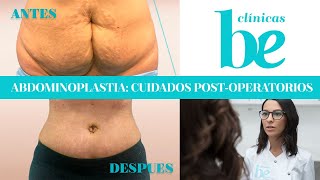 Abdominoplastia o cirugía de abdomen cuidados postoperatorios  Clínicas Be [upl. by Kieran]