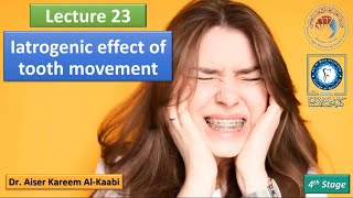 Iatrogenic effect of tooth movement lec23 تقويم الأسنان للمرحلة الرابعة [upl. by Lowenstein812]