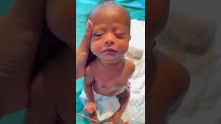 Down Syndrome Babycutebabyviralvideo [upl. by Onitnelav977]