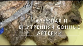 Наружная и внутренняя сонные артерии [upl. by Lunnete]