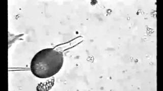 Rop1Ps promote actin cytoskeleton dynamics and control the tip growth of lily pollen tube [upl. by Submuloc]