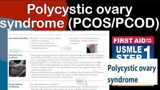 Polycystic ovary syndrome PCOSPCOD in HindiUrdu by first aid for USMLE step 1 [upl. by Knorring]