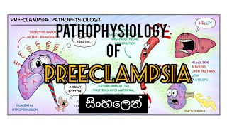 Pathophysiology of Preeclampsia  සිංහලෙන් [upl. by Soilisav291]