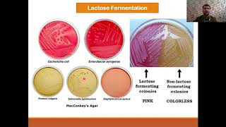 Classification of Enterobacteriaceae  Biochemical identification and complications [upl. by Sy]