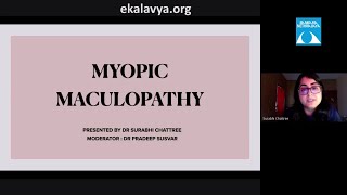 Myopic Maculopathy Dr Surabhi Chattree 16 July 2020 [upl. by Butta]